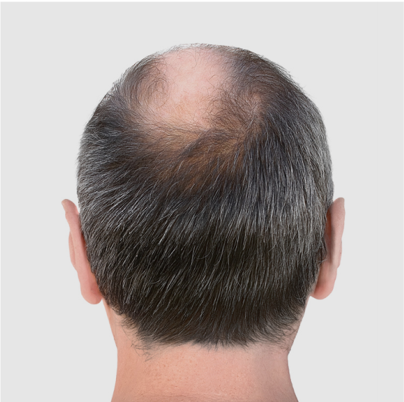 Before 12month