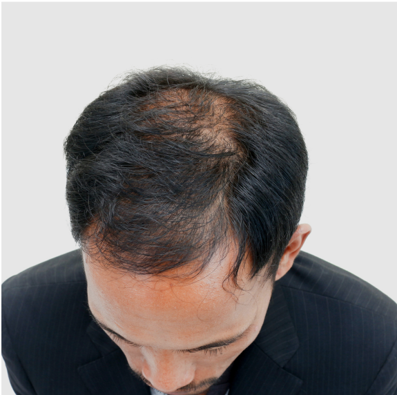 Before 6month